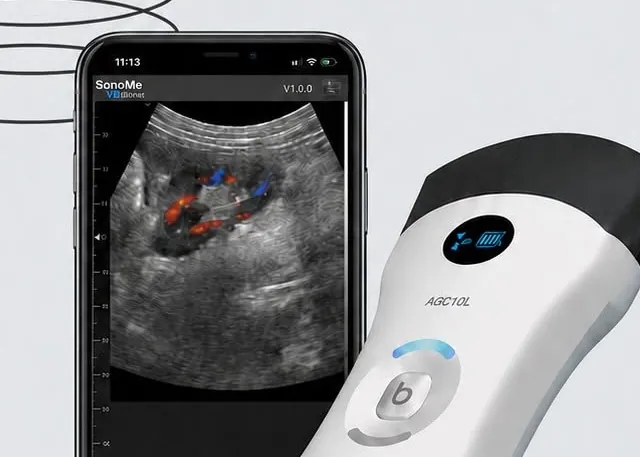 Đầu dò SonoMe AGC10L và màn hình ứng dụng SonoMe Pro
