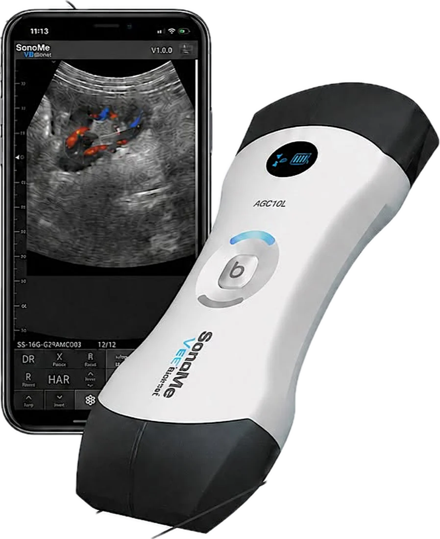 SonoMe – máy siêu âm cầm tay bionet AGC10L